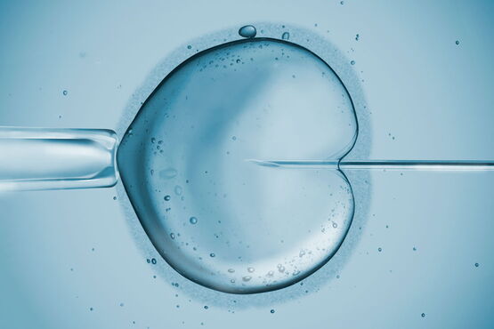 ICSI – Kinderwunschbehandlung durch intrazytoplasmatische Spermieninjektion ICSI – Kinderwunschbehandlung durch intrazytoplasmatische Spermieninjektion