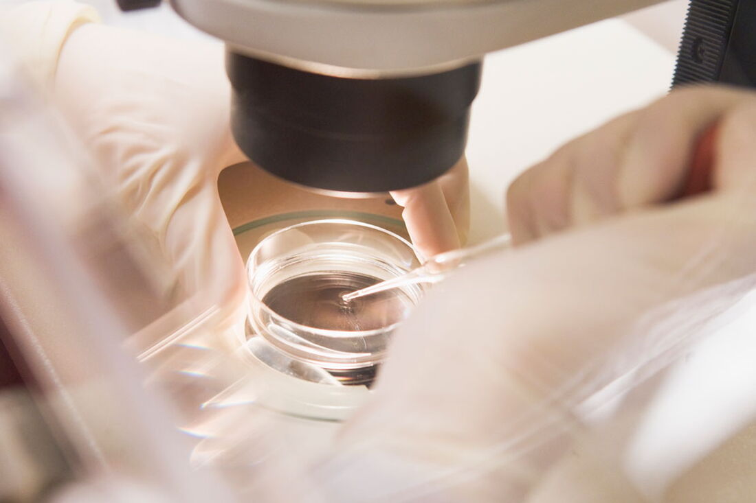 IVF – Befruchtung in der Petrischale
