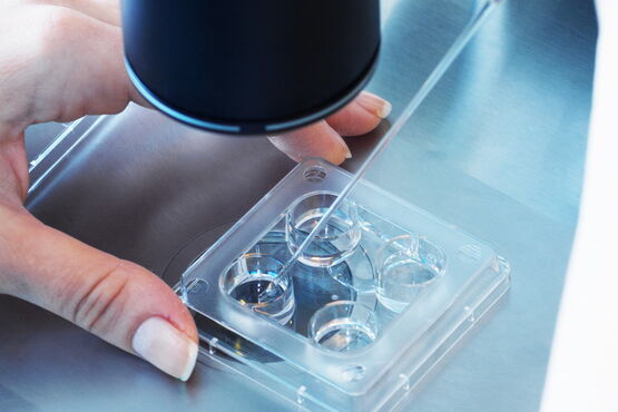 Kinderwunsch Untersuchung beim Mann Kinderwunsch Untersuchung beim Mann